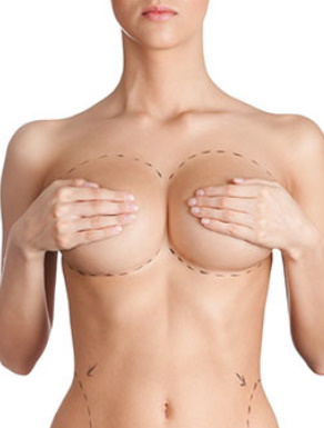 Lipofilling mammaire Tunisie