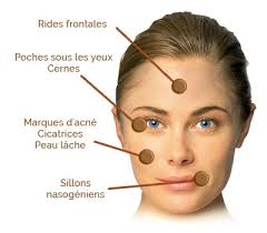prp visage cheveux tunisie