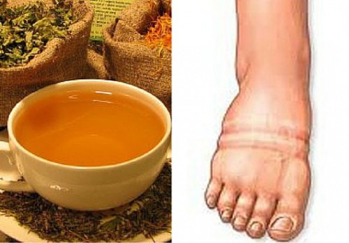 causes de la rétention d’eau