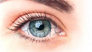 Sécheresse oculaire