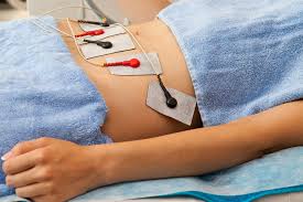 solutions au relachement ventre