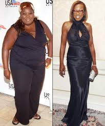 Star Jones après chirurgie esthétique