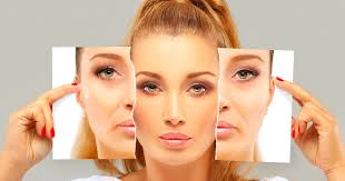 mini lifting visage tunisie