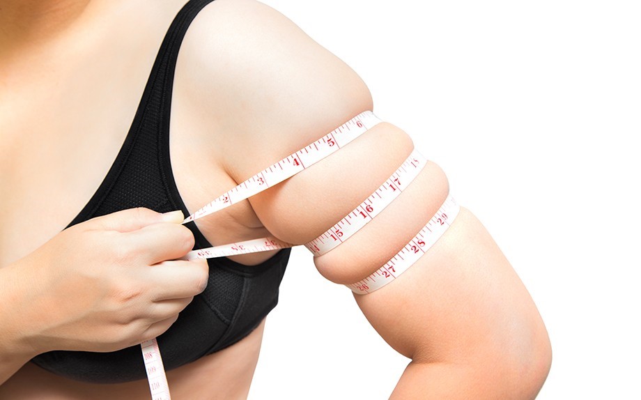 CoolSculpting