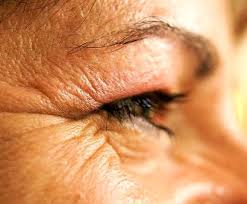 types vieillissement