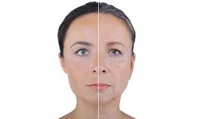 mini lift visage
