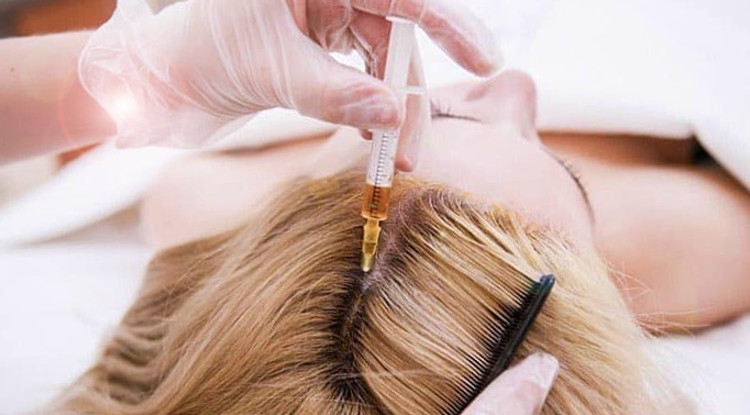 mesotherapie cheveux