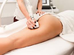 technique anti cellulite sans chirurgie