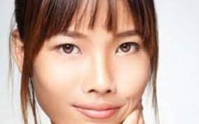 blépharoplastie paupière asiatique