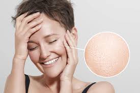 traitement pores dilatés