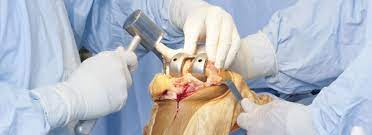 chirurgie articulation