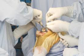 chirurgie douleur genou
