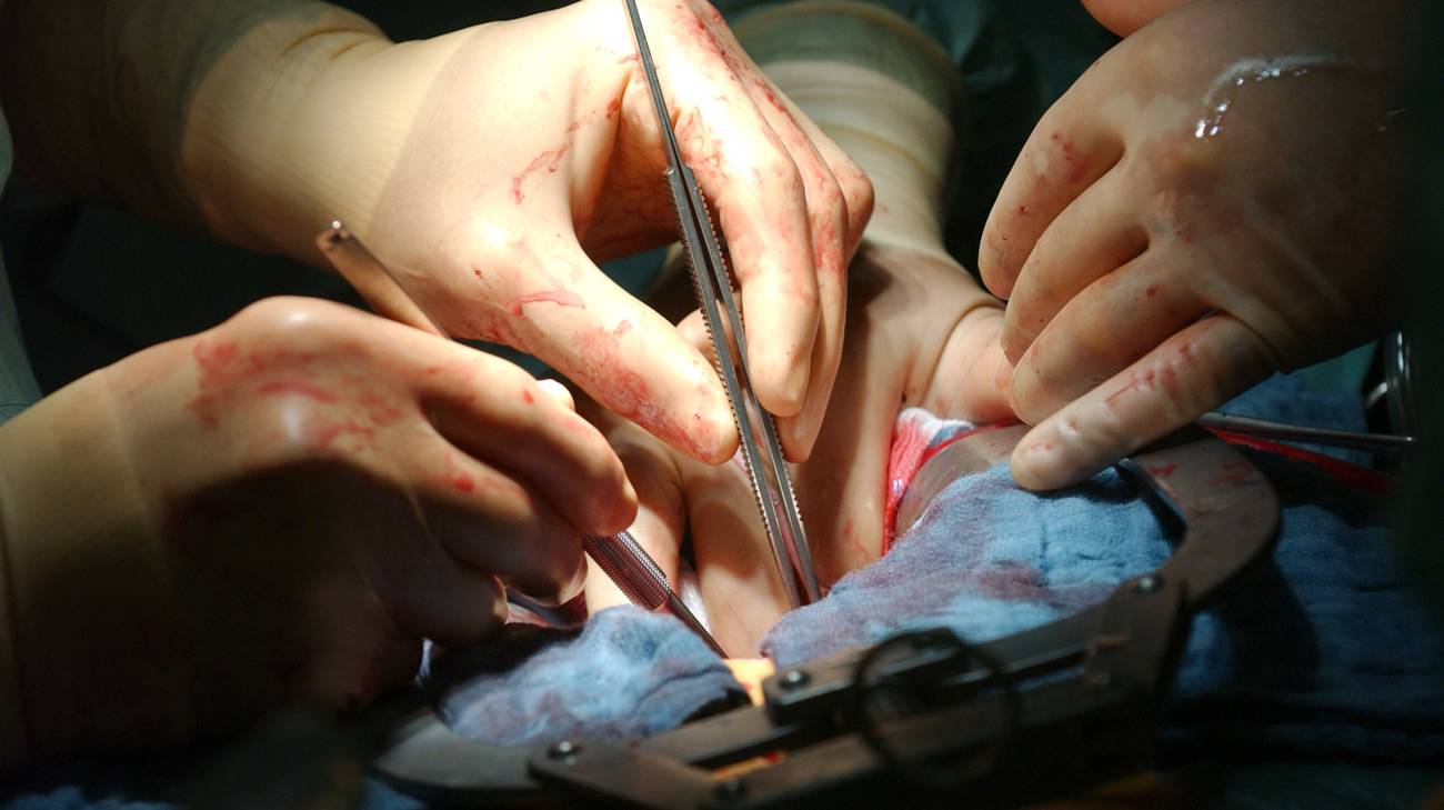 techniques chirurgie digestive